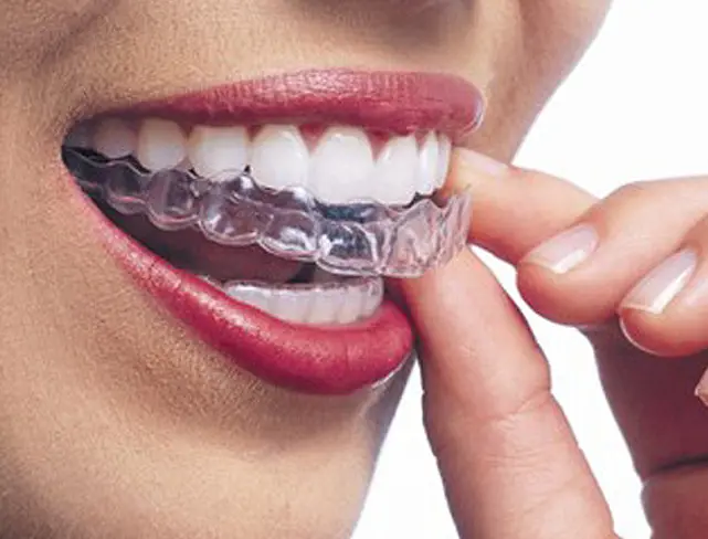 Invisalign in Peterborough